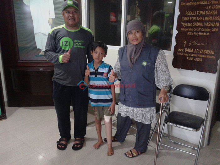 Dede Sekarang Punya Kaki, IZI Gulirkan Program 1000 Kaki Palsu