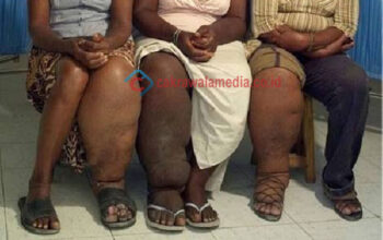 Kota Cimahi Aman Filariasis!