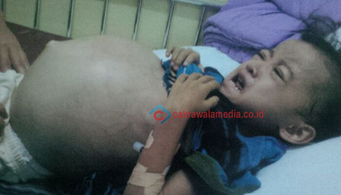DPRD Katanya Wakil Rakyat, Tapi Malah Acuhkan Warganya di Cimahi