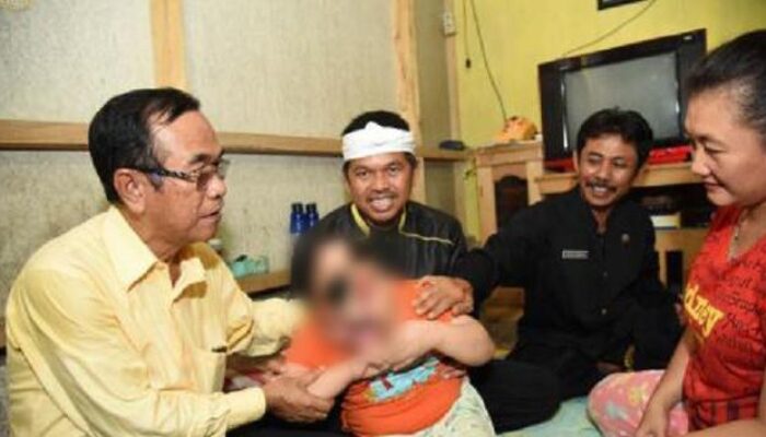 Enam Tahun Hidup Tanpa Tempurung Kepala