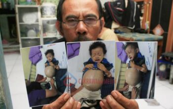 Genap Sebulan, Adel Penderita Kanker Belum Juga Dioperasi