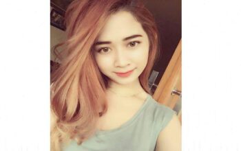 Minggu Ini, Ali Targetkan Operasi Rekonstruksi Intan Novianti