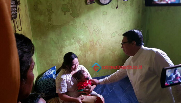 Tumor Mata Rafa Kian Membesar, Golkar KBB Pun Turun Tangan