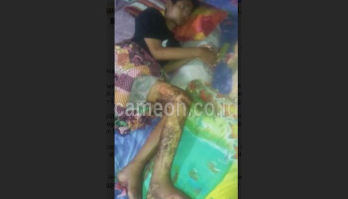 Perceraian Orang Tua Berdampak Besar Terhadap Anak