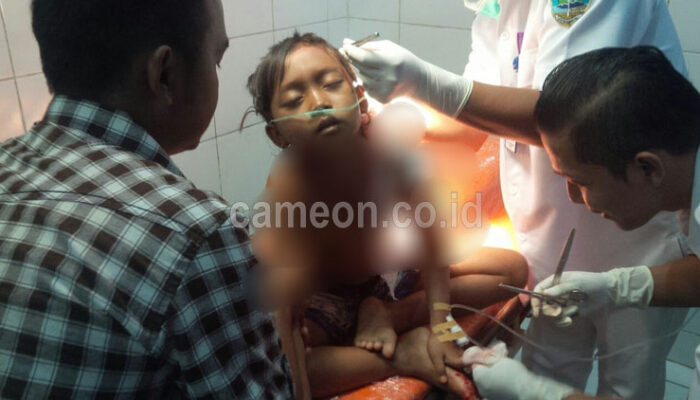 Dua Bocah di Tasikmalaya Diduga Jadi Korban Penganiayan, Satu Tewas