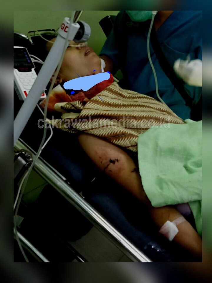 Rindu Menengok Si Buah Hati, Malah Dibacok Mantan Suami 