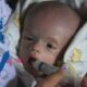 Alfarizky Bayi 50 Hari Penderita Spina Bipida, Tak Mampu Berobat