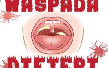 Tak Mau Ambil Pusing, Pemkab Tasikmalaya Tetapkan KLB Diftery Meski Baru Satu Penderita Positif