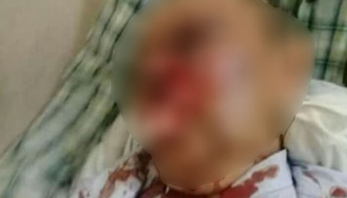 Dihajar Orang Tak Dikenal, Ceng Emon Santiong dilarikan ke Rumah Sakit