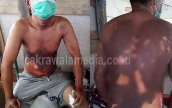 Tabung Gas 3 Kg Meledak di Pangandaran, 1 Orang Terluka