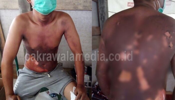 Tabung Gas 3 Kg Meledak di Pangandaran, 1 Orang Terluka