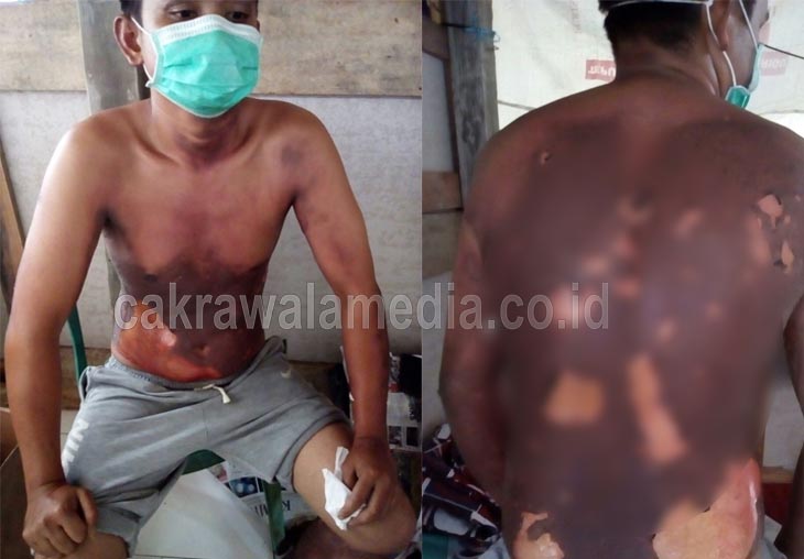 Tabung Gas 3 Kg Meledak di Pangandaran, 1 Orang Terluka