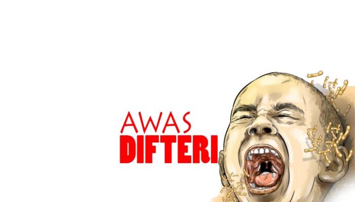 Dinas Kesehatan Kota Cimahi: Satu Orang Meninggal Akibat Difteri
