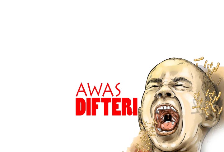 Dinas Kesehatan Kota Cimahi: Satu Orang Meninggal Akibat Difteri