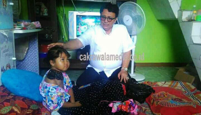 Bocah Penderita Tumor Ganas Asal Ciburuy Akhirnya Meninggal