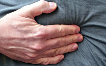 Gejala, Penyebab dan Cara Mengobati Penyakit Hernia