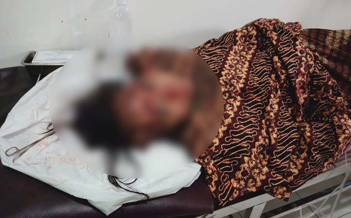 istri dibacok di pangandaran