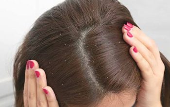 Tren Baru Perawatan Rambut Alami, Jahe Ternyata Bisa Atasi Uban dan Ketombe!